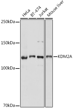 Western blot analysis of extracts of various cell lines, using KDM2A antibody (TA377751) at 1:1000 dilution. - Secondary antibody: HRP Goat Anti-Rabbit IgG (H+L) at 1:10000 dilution. - Lysates/proteins: 25ug per lane. - Blocking buffer: 3% nonfat dry milk in TBST. - Detection: ECL Basic Kit . - Exposure time: 3s.