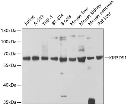 Western blot analysis of extracts of various cell lines, using KIR3DS1 antibody (TA377821) at 1:1000 dilution. - Secondary antibody: HRP Goat Anti-Rabbit IgG (H+L) at 1:10000 dilution. - Lysates/proteins: 25ug per lane. - Blocking buffer: 3% nonfat dry milk in TBST. - Detection: ECL Basic Kit . - Exposure time: 60s.