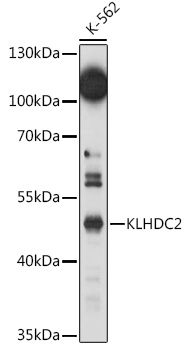 Western blot analysis of extracts of K-562 cells, using KLHDC2 antibody (TA377846) at 1:1000 dilution. - Secondary antibody: HRP Goat Anti-Rabbit IgG (H+L) at 1:10000 dilution. - Lysates/proteins: 25ug per lane. - Blocking buffer: 3% nonfat dry milk in TBST. - Detection: ECL Basic Kit . - Exposure time: 150s.