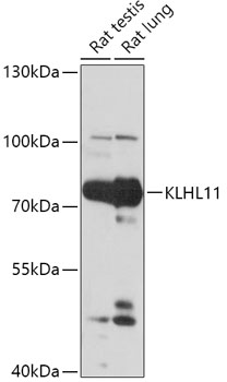 Western blot analysis of extracts of various cell lines, using KLHL11 antibody (TA377850) at 1:1000 dilution. - Secondary antibody: HRP Goat Anti-Rabbit IgG (H+L) at 1:10000 dilution. - Lysates/proteins: 25ug per lane. - Blocking buffer: 3% nonfat dry milk in TBST. - Detection: ECL Basic Kit . - Exposure time: 30s.