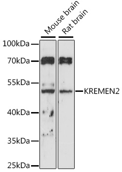 Western blot analysis of extracts of various cell lines, using KREMEN2 antibody (TA377897) at 1:1000 dilution. - Secondary antibody: HRP Goat Anti-Rabbit IgG (H+L) at 1:10000 dilution. - Lysates/proteins: 25ug per lane. - Blocking buffer: 3% nonfat dry milk in TBST. - Detection: ECL Basic Kit . - Exposure time: 120s.