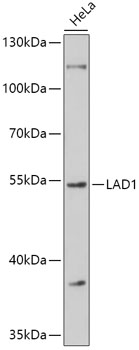 Western blot analysis of extracts of HeLa cells, using LAD1 antibody (TA377932) at 1:1000 dilution. - Secondary antibody: HRP Goat Anti-Rabbit IgG (H+L) at 1:10000 dilution. - Lysates/proteins: 25ug per lane. - Blocking buffer: 3% nonfat dry milk in TBST. - Detection: ECL Basic Kit . - Exposure time: 60s.