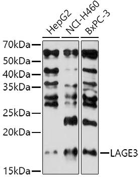 Western blot analysis of extracts of various cell lines, using LAGE3 antibody (TA377934) at 1:1000 dilution. - Secondary antibody: HRP Goat Anti-Rabbit IgG (H+L) at 1:10000 dilution. - Lysates/proteins: 25ug per lane. - Blocking buffer: 3% nonfat dry milk in TBST. - Detection: ECL Basic Kit . - Exposure time: 180s.