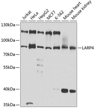 HEK293T cells were transfected with the pCMV6-ENTRY control (Left lane) or pCMV6-ENTRY SLU7 (RC202113, Right lane) cDNA for 48 hrs and lysed. Equivalent amounts of cell lysates (5 ug per lane) were separated by SDS-PAGE and immunoblotted with anti-SLU7. Positive lysates LY416650 (100 ug) and LC416650 (20 ug) can be purchased separately from OriGene.