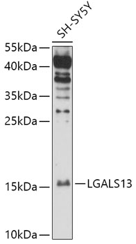 HEK293T cells were transfected with the pCMV6-ENTRY control (Left lane) or pCMV6-ENTRY DUSP5 (RC209128, Right lane) cDNA for 48 hrs and lysed. Equivalent amounts of cell lysates (5 ug per lane) were separated by SDS-PAGE and immunoblotted with anti-DUSP5 (1:2000). Positive lysates LY417998 (100 ug) and LC417998 (20 ug) can be purchased separately from OriGene.