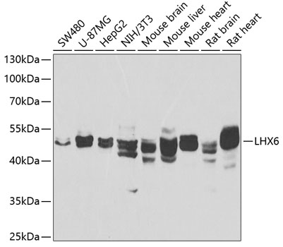 Western blot analysis of extracts of various cell lines, using LHX6 antibody (TA378030) at 1:1000 dilution._Secondary antibody: HRP Goat Anti-Rabbit IgG (H+L) at 1:10000 dilution._Lysates/proteins: 25ug per lane._Blocking buffer: 3% nonfat dry milk in TBST._Detection: ECL Enhanced Kit ._Exposure time: 90s.
