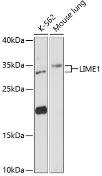 Western blot analysis of extracts of various cell lines, using LIME1 antibody (TA378048) at 1:3000 dilution. - Secondary antibody: HRP Goat Anti-Rabbit IgG (H+L) at 1:10000 dilution. - Lysates/proteins: 25ug per lane. - Blocking buffer: 3% nonfat dry milk in TBST. - Detection: ECL Basic Kit . - Exposure time: 90s.