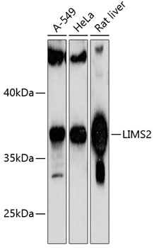 Western blot analysis of extracts of various cell lines, using LIMS2 antibody (TA378053) at 1:1000 dilution. - Secondary antibody: HRP Goat Anti-Rabbit IgG (H+L) at 1:10000 dilution. - Lysates/proteins: 25ug per lane. - Blocking buffer: 3% nonfat dry milk in TBST. - Detection: ECL Basic Kit . - Exposure time: 60s.