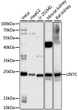 Western blot analysis of extracts of various cell lines, using LIN7°C antibody (TA378057) at 1:1000 dilution. - Secondary antibody: HRP Goat Anti-Rabbit IgG (H+L) at 1:10000 dilution. - Lysates/proteins: 25ug per lane. - Blocking buffer: 3% nonfat dry milk in TBST. - Detection: ECL Basic Kit . - Exposure time: 3s.