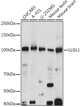 Western blot analysis of extracts of various cell lines, using LLGL1 antibody (TA378072) at 1:1000 dilution. - Secondary antibody: HRP Goat Anti-Rabbit IgG (H+L) at 1:10000 dilution. - Lysates/proteins: 25ug per lane. - Blocking buffer: 3% nonfat dry milk in TBST. - Detection: ECL Basic Kit . - Exposure time: 10s.