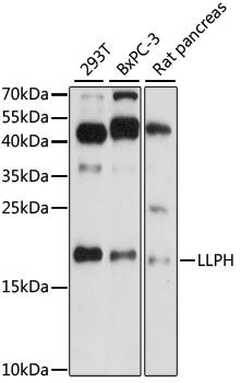 Western blot analysis of extracts of various cell lines, using LLPH antibody (TA378076) at 1:1000 dilution. - Secondary antibody: HRP Goat Anti-Rabbit IgG (H+L) at 1:10000 dilution. - Lysates/proteins: 25ug per lane. - Blocking buffer: 3% nonfat dry milk in TBST. - Detection: ECL Basic Kit . - Exposure time: 90s.
