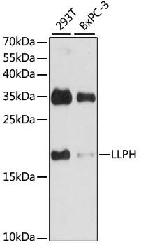Western blot analysis of extracts of various cell lines, using LLPH antibody (TA378077) at 1:1000 dilution. - Secondary antibody: HRP Goat Anti-Rabbit IgG (H+L) at 1:10000 dilution. - Lysates/proteins: 25ug per lane. - Blocking buffer: 3% nonfat dry milk in TBST. - Detection: ECL Basic Kit . - Exposure time: 30s.