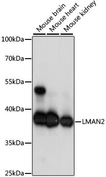 Western blot analysis of extracts of various cell lines, using LMAN2 antibody (TA378079) at 1:1000 dilution. - Secondary antibody: HRP Goat Anti-Rabbit IgG (H+L) at 1:10000 dilution. - Lysates/proteins: 25ug per lane. - Blocking buffer: 3% nonfat dry milk in TBST. - Detection: ECL Basic Kit . - Exposure time: 1s.