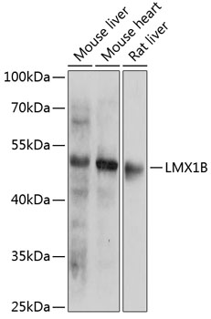 Western blot analysis of extracts of various cell lines, using LMX1B antibody (TA378090) at 1:1000 dilution. - Secondary antibody: HRP Goat Anti-Rabbit IgG (H+L) at 1:10000 dilution. - Lysates/proteins: 25ug per lane. - Blocking buffer: 3% nonfat dry milk in TBST. - Detection: ECL Basic Kit . - Exposure time: 90s.