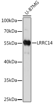 HEK293T cells were transfected with the pCMV6-ENTRY control (Left lane) or pCMV6-ENTRY ELF1 (RC207140, Right lane) cDNA for 48 hrs and lysed. Equivalent amounts of cell lysates (5 ug per lane) were separated by SDS-PAGE and immunoblotted with anti-ELF1 (1:2000).