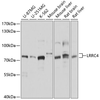 Western blot analysis of extracts of various cell lines, using LRRC4 antibody (TA378134) at 1:1000 dilution. - Secondary antibody: HRP Goat Anti-Rabbit IgG (H+L) at 1:10000 dilution. - Lysates/proteins: 25ug per lane. - Blocking buffer: 3% nonfat dry milk in TBST. - Detection: ECL Basic Kit . - Exposure time: 1s.