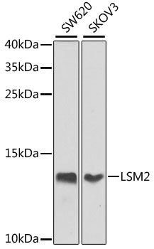 HEK293T cells were transfected with the pCMV6-ENTRY control (Cat# PS100001, Left lane) or pCMV6-ENTRY ELF1 (Cat# RC207140, Right lane) cDNA for 48 hrs and lysed. Equivalent amounts of cell lysates (5 ug per lane) were separated by SDS-PAGE and immunoblotted with anti-ELF1 (Cat# TA811235)(1:2000).