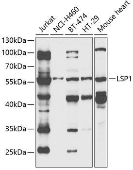 HEK293T cells were transfected with the pCMV6-ENTRY control (Left lane) or pCMV6-ENTRY EXOC4 (RC221799, Right lane) cDNA for 48 hrs and lysed. Equivalent amounts of cell lysates (5 ug per lane) were separated by SDS-PAGE and immunoblotted with anti-EXOC4 (1:500). Positive lysates LY422147 (100 ug) and LC422147 (20 ug) can be purchased separately from OriGene.