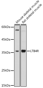 Western blot analysis of extracts of various cell lines, using LTB4R antibody (TA378160) at 1:1000 dilution. - Secondary antibody: HRP Goat Anti-Rabbit IgG (H+L) at 1:10000 dilution. - Lysates/proteins: 25ug per lane. - Blocking buffer: 3% nonfat dry milk in TBST. - Detection: ECL Basic Kit . - Exposure time: 180s.