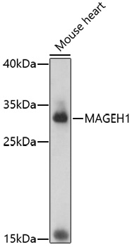 Western blot analysis of extracts of mouse heart, using MAGEH1 antibody (TA378208) at 1:1000 dilution. - Secondary antibody: HRP Goat Anti-Rabbit IgG (H+L) at 1:10000 dilution. - Lysates/proteins: 25ug per lane. - Blocking buffer: 3% nonfat dry milk in TBST. - Detection: ECL Basic Kit . - Exposure time: 180s.