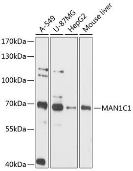Western blot analysis of extracts of various cell lines, using MAN1C1 antibody (TA378220) at 1:3000 dilution. - Secondary antibody: HRP Goat Anti-Rabbit IgG (H+L) at 1:10000 dilution. - Lysates/proteins: 25ug per lane. - Blocking buffer: 3% nonfat dry milk in TBST. - Detection: ECL Basic Kit . - Exposure time: 90s.