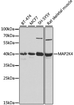 HEK293T cells were transfected with the pCMV6-ENTRY control (Left lane) or pCMV6-ENTRY FAM54A (RC213401, Right lane) cDNA for 48 hrs and lysed. Equivalent amounts of cell lysates (5 ug per lane) were separated by SDS-PAGE and immunoblotted with anti-FAM54A (1:2000). Positive lysates LY426058 (100 ug) and LC426058 (20 ug) can be purchased separately from OriGene.