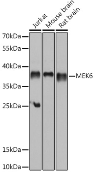 Western blot analysis of extracts of various cell lines, using MEK6 antibody (TA378259) at 1:1000 dilution. - Secondary antibody: HRP Goat Anti-Rabbit IgG (H+L) at 1:10000 dilution. - Lysates/proteins: 25ug per lane. - Blocking buffer: 3% nonfat dry milk in TBST. - Detection: ECL Basic Kit . - Exposure time: 10s.