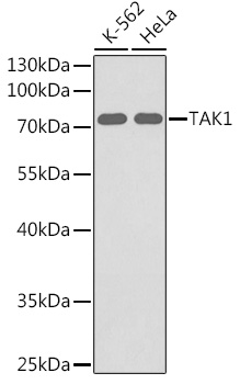 Western blot analysis of extracts of various cell lines, using TAK1 antibody (TA378276). - Secondary antibody: HRP Goat Anti-Rabbit IgG (H+L) at 1:10000 dilution. - Lysates/proteins: 25ug per lane. - Blocking buffer: 3% nonfat dry milk in TBST.