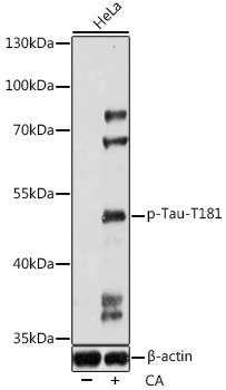 HEK293T cells were transfected with the pCMV6-ENTRY control (Left lane) or pCMV6-ENTRY EGF (RC210817, Right lane) cDNA for 48 hrs and lysed. Equivalent amounts of cell lysates (5 ug per lane) were separated by SDS-PAGE and immunoblotted with anti-EGF (1:2000). Positive lysates LY419624 (100 ug) and LC419624 (20 ug) can be purchased separately from OriGene.