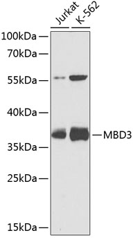 Western blot analysis of extracts of various cell lines, using MBD3 antibody (TA378369) at 1:1000 dilution. - Secondary antibody: HRP Goat Anti-Rabbit IgG (H+L) at 1:10000 dilution. - Lysates/proteins: 25ug per lane. - Blocking buffer: 3% nonfat dry milk in TBST. - Detection: ECL Basic Kit . - Exposure time: 10s.