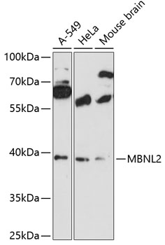 Western blot analysis of extracts of various cell lines, using MBNL2 antibody (TA378374) at 1:3000 dilution. - Secondary antibody: HRP Goat Anti-Rabbit IgG (H+L) at 1:10000 dilution. - Lysates/proteins: 25ug per lane. - Blocking buffer: 3% nonfat dry milk in TBST. - Detection: ECL Basic Kit . - Exposure time: 90s.