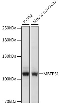 Western blot analysis of extracts of various cell lines, using MBTPS1 antibody (TA378375) at 1:1000 dilution. - Secondary antibody: HRP Goat Anti-Rabbit IgG (H+L) at 1:10000 dilution. - Lysates/proteins: 25ug per lane. - Blocking buffer: 3% nonfat dry milk in TBST. - Detection: ECL Basic Kit . - Exposure time: 1s.