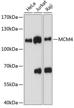 HEK293T cells were transfected with the pCMV6-ENTRY control (Left lane) or pCMV6-ENTRY EEF1D (RC224856, Right lane) cDNA for 48 hrs and lysed. Equivalent amounts of cell lysates (5 ug per lane) were separated by SDS-PAGE and immunoblotted with anti-EEF1D (1:2000). Positive lysates LY429804 (100 ug) and LC429804 (20 ug) can be purchased separately from OriGene.