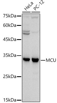 Western blot analysis of extracts of various cell lines, using MCU antibody (TA378411) at 1:500 dilution. - Secondary antibody: HRP Goat Anti-Rabbit IgG (H+L) at 1:10000 dilution. - Lysates/proteins: 25ug per lane. - Blocking buffer: 3% nonfat dry milk in TBST. - Detection: ECL Basic Kit . - Exposure time: 90s.