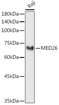 Western blot analysis of extracts of Raji cells, using MED26 antibody (TA378438) at 1:1000 dilution. - Secondary antibody: HRP Goat Anti-Rabbit IgG (H+L) at 1:10000 dilution. - Lysates/proteins: 25ug per lane. - Blocking buffer: 3% nonfat dry milk in TBST. - Detection: ECL Basic Kit . - Exposure time: 3s.