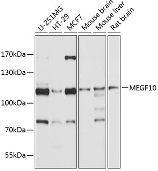 Western blot analysis of extracts of various cell lines, using MEGF10 antibody (TA378452) at 1:1000 dilution. - Secondary antibody: HRP Goat Anti-Rabbit IgG (H+L) at 1:10000 dilution. - Lysates/proteins: 25ug per lane. - Blocking buffer: 3% nonfat dry milk in TBST. - Detection: ECL Basic Kit . - Exposure time: 10s.