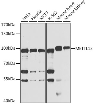 Western blot analysis of extracts of various cell lines, using METTL13 antibody (TA378476) at 1:1000 dilution. - Secondary antibody: HRP Goat Anti-Rabbit IgG (H+L) at 1:10000 dilution. - Lysates/proteins: 25ug per lane. - Blocking buffer: 3% nonfat dry milk in TBST. - Detection: ECL Basic Kit . - Exposure time: 10s.