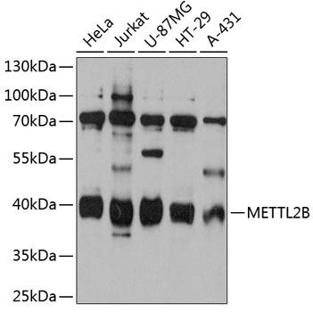 Western blot analysis of extracts of various cell lines, using METTL2B antibody (TA378481) at 1:3000 dilution. - Secondary antibody: HRP Goat Anti-Rabbit IgG (H+L) at 1:10000 dilution. - Lysates/proteins: 25ug per lane. - Blocking buffer: 3% nonfat dry milk in TBST. - Detection: ECL Basic Kit . - Exposure time: 90s.