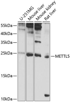 Western blot analysis of extracts of various cell lines, using METTL5 antibody (TA378484) at 1:1000 dilution. - Secondary antibody: HRP Goat Anti-Rabbit IgG (H+L) at 1:10000 dilution. - Lysates/proteins: 25ug per lane. - Blocking buffer: 3% nonfat dry milk in TBST. - Detection: ECL Basic Kit . - Exposure time: 8s.