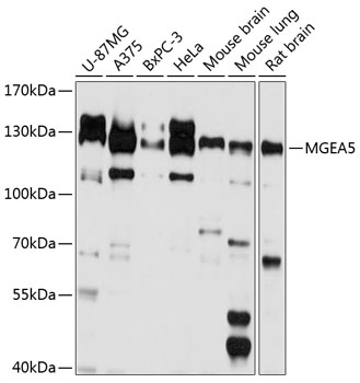 Western blot analysis of extracts of various cell lines, using MGEA5 antibody (TA378511) at 1:1000 dilution. - Secondary antibody: HRP Goat Anti-Rabbit IgG (H+L) at 1:10000 dilution. - Lysates/proteins: 25ug per lane. - Blocking buffer: 3% nonfat dry milk in TBST. - Detection: ECL Basic Kit . - Exposure time: 10s.