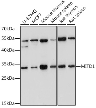 Western blot analysis of extracts of various cell lines, using MITD1 Rabbit pAb (TA378537) at 1:1000 dilution. - Secondary antibody: HRP Goat Anti-Rabbit IgG (H+L) at 1:10000 dilution. - Lysates/proteins: 25ug per lane. - Blocking buffer: 3% nonfat dry milk in TBST. - Detection: ECL Enhanced Kit . - Exposure time: 180s.