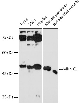 Western blot analysis of extracts of various cell lines, using MKNK1 antibody (TA378547) at 1:1000 dilution. - Secondary antibody: HRP Goat Anti-Rabbit IgG (H+L) at 1:10000 dilution. - Lysates/proteins: 25ug per lane. - Blocking buffer: 3% nonfat dry milk in TBST. - Detection: ECL Basic Kit . - Exposure time: 3min.