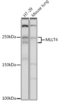 Western blot analysis of extracts of various cell lines, using MLLT4 antibody (TA378568) at 1:1000 dilution. - Secondary antibody: HRP Goat Anti-Rabbit IgG (H+L) at 1:10000 dilution. - Lysates/proteins: 25ug per lane. - Blocking buffer: 3% nonfat dry milk in TBST. - Detection: ECL Basic Kit . - Exposure time: 1s.