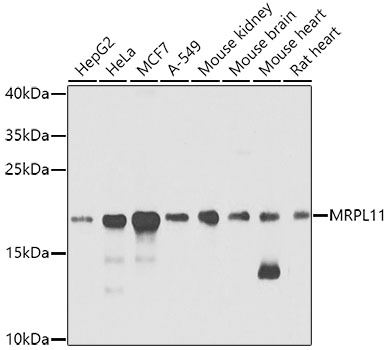 Western blot analysis of extracts of various cell lines, using MRPL11 antibody (TA378636) at 1:1000 dilution. - Secondary antibody: HRP Goat Anti-Rabbit IgG (H+L) at 1:10000 dilution. - Lysates/proteins: 25ug per lane. - Blocking buffer: 3% nonfat dry milk in TBST. - Detection: ECL Basic Kit . - Exposure time: 40s.