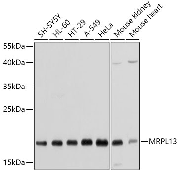 Western blot analysis of extracts (35 ug) from tissue lysate by using anti-ATP2A2 monoclonal antibody (1:500).