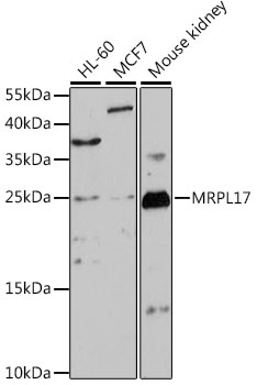 Western blot analysis of extracts of various cell lines, using MRPL17 antibody (TA378641) at 1:1000 dilution. - Secondary antibody: HRP Goat Anti-Rabbit IgG (H+L) at 1:10000 dilution. - Lysates/proteins: 25ug per lane. - Blocking buffer: 3% nonfat dry milk in TBST. - Detection: ECL Basic Kit . - Exposure time: 3min.