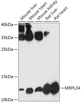 Western blot analysis of extracts of various cell lines, using MRPL34 antibody (TA378650) at 1:1000 dilution. - Secondary antibody: HRP Goat Anti-Rabbit IgG (H+L) at 1:10000 dilution. - Lysates/proteins: 25ug per lane. - Blocking buffer: 3% nonfat dry milk in TBST. - Detection: ECL Basic Kit . - Exposure time: 90s.