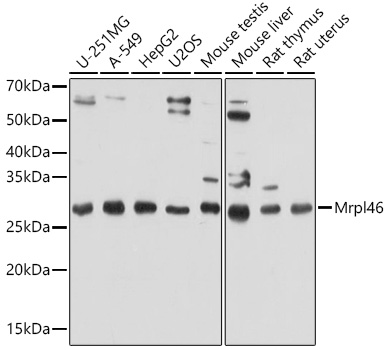 Western blot analysis of extracts of various cell lines, using Mrpl46 antibody (TA378660) at 1:1000 dilution. - Secondary antibody: HRP Goat Anti-Rabbit IgG (H+L) at 1:10000 dilution. - Lysates/proteins: 25ug per lane. - Blocking buffer: 3% nonfat dry milk in TBST. - Detection: ECL Basic Kit . - Exposure time: 30s.