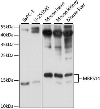 Western blot analysis of extracts of various cell lines, using MRPS14 antibody (TA378668) at 1:1000 dilution. - Secondary antibody: HRP Goat Anti-Rabbit IgG (H+L) at 1:10000 dilution. - Lysates/proteins: 25ug per lane. - Blocking buffer: 3% nonfat dry milk in TBST. - Detection: ECL Basic Kit . - Exposure time: 10s.
