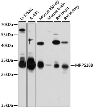 HEK293T cells were transfected with the pCMV6-ENTRY control (Left lane) or pCMV6-ENTRY BST1 (RC204151, Right lane) cDNA for 48 hrs and lysed. Equivalent amounts of cell lysates (5 ug per lane) were separated by SDS-PAGE and immunoblotted with anti-BST1. Positive lysates LY418052 (100 ug) and LC418052 (20 ug) can be purchased separately from OriGene.